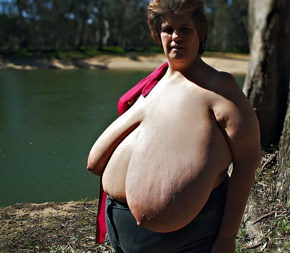 Giantomastia Big Black Tits