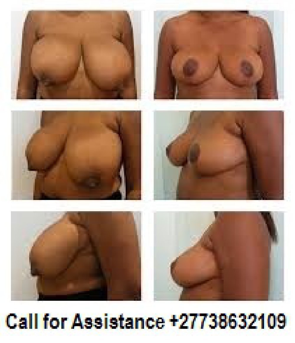 Forms of naked female breast