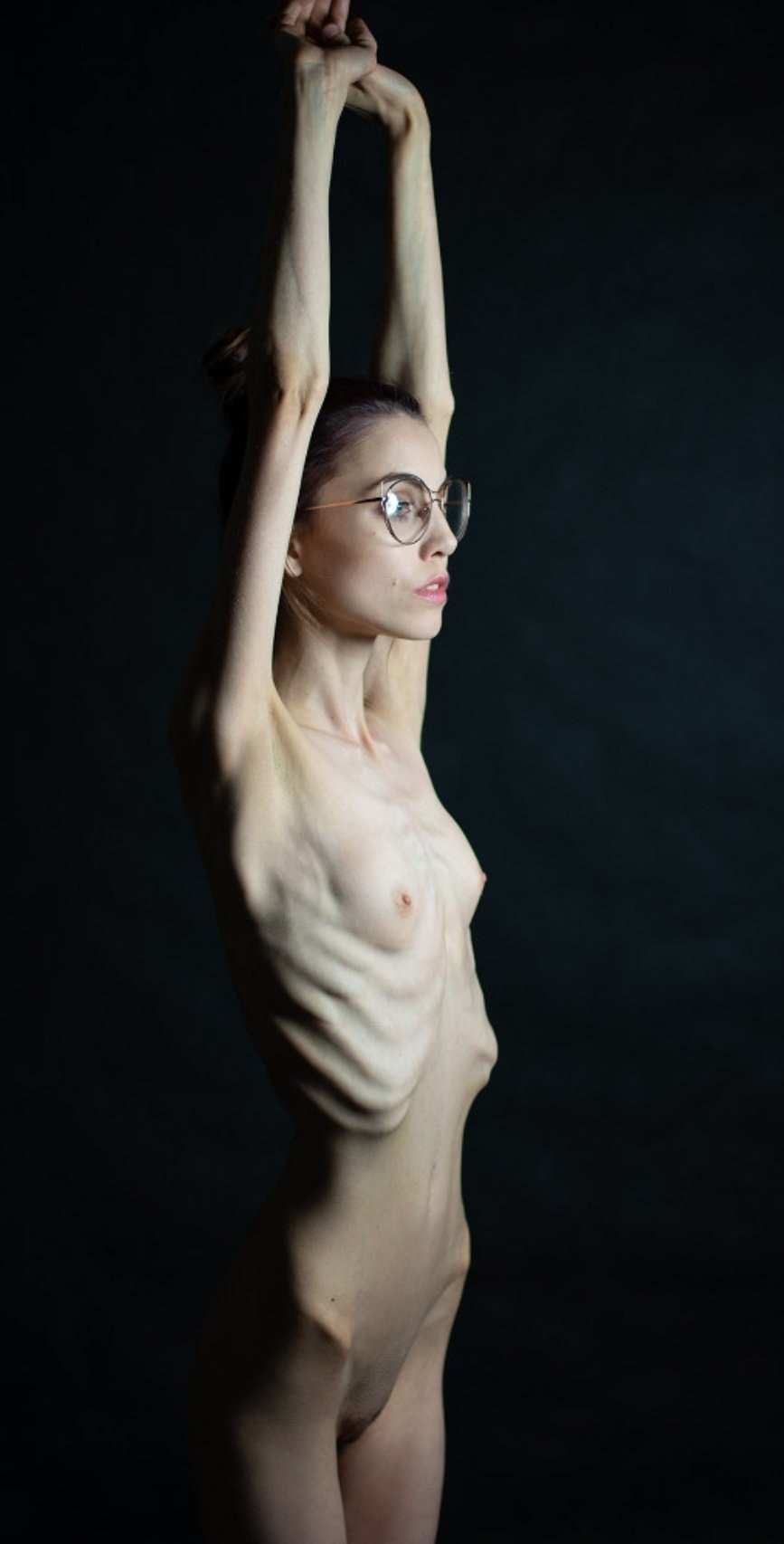 Anorexics are erotic