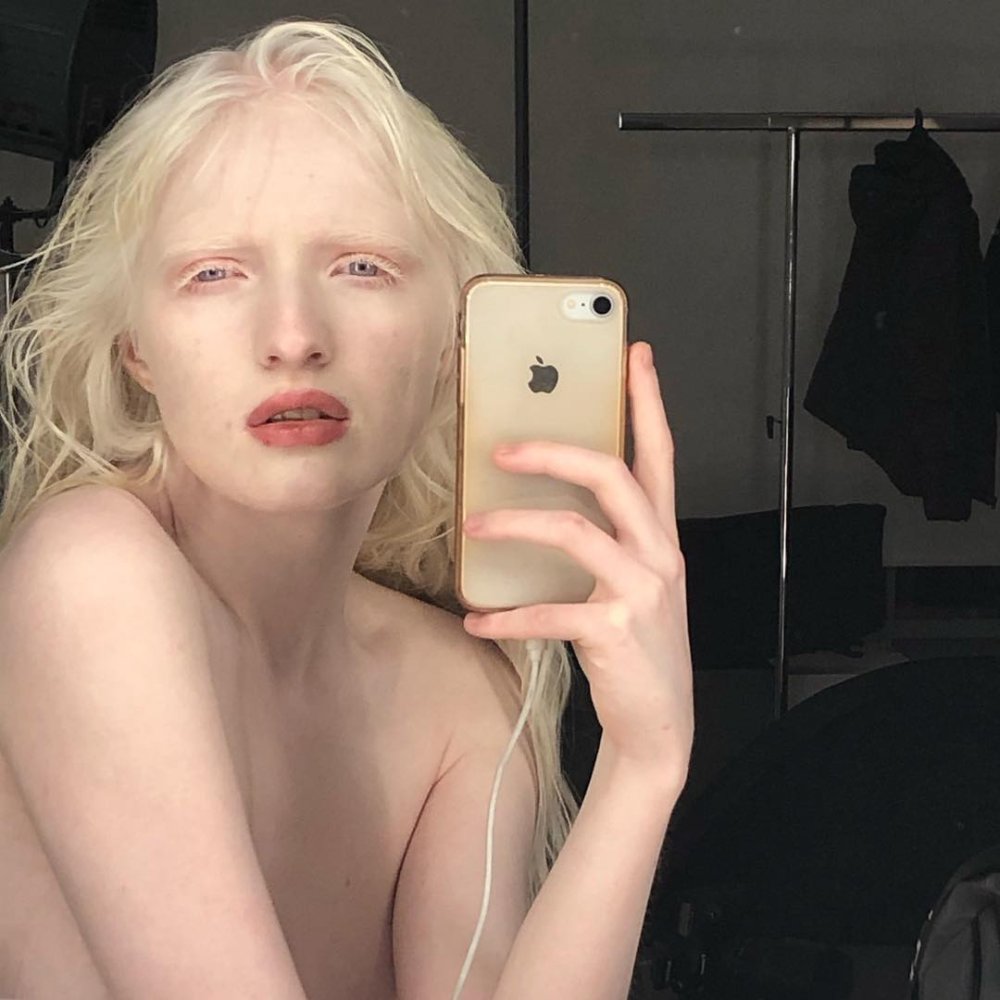 The girl Albino is naked