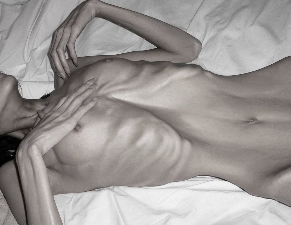Naked anorexici with big breasts