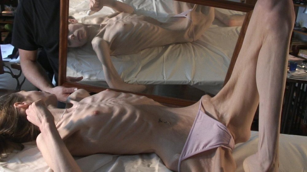 Naked anorexics are large