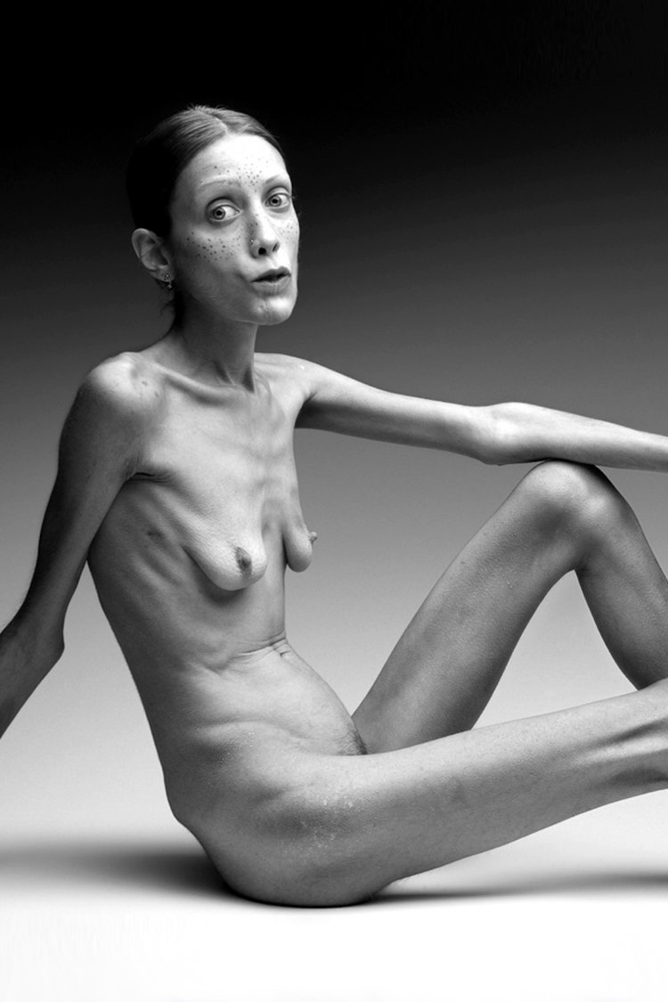 Very thin girls topless
