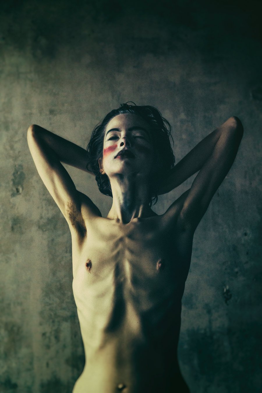 Fully naked anorexics
