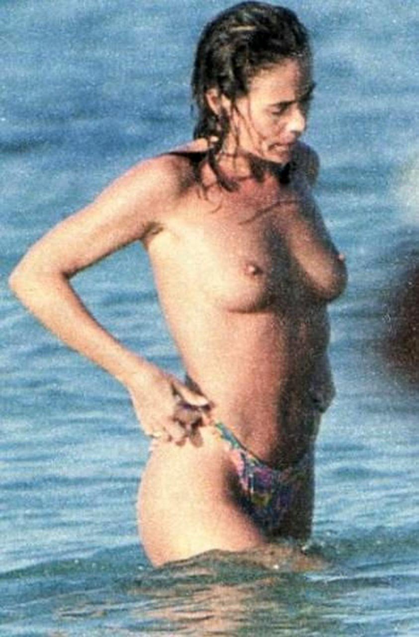 Marion Kotiyar breast