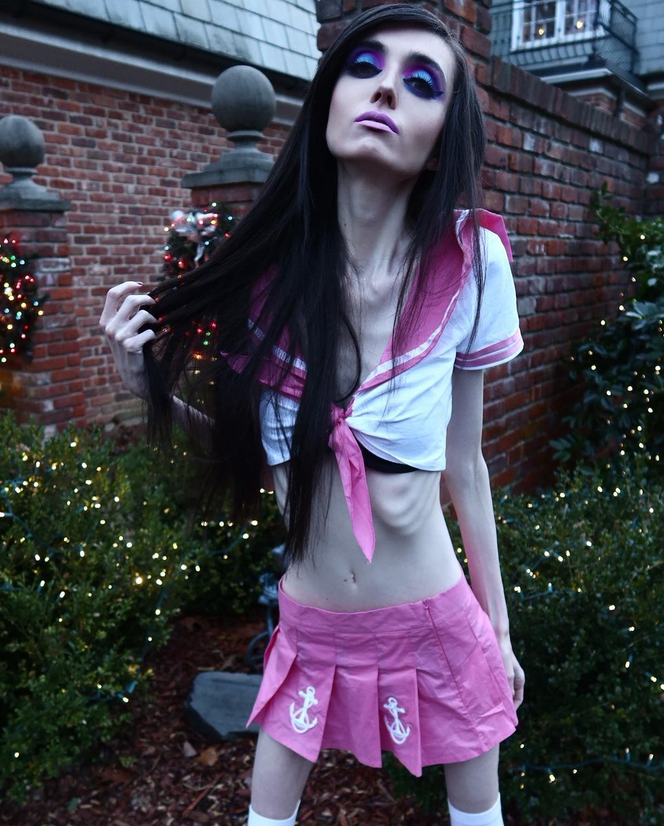 Eugenia Cooney anorexia