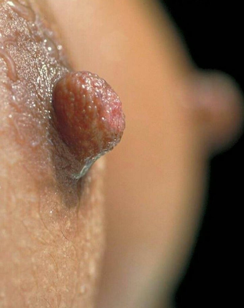 Beautiful erotic girls