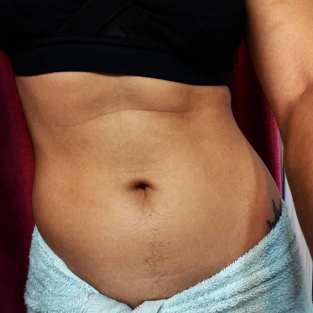 Natusik Belly