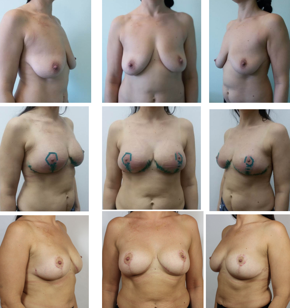 Naked women of different shapes