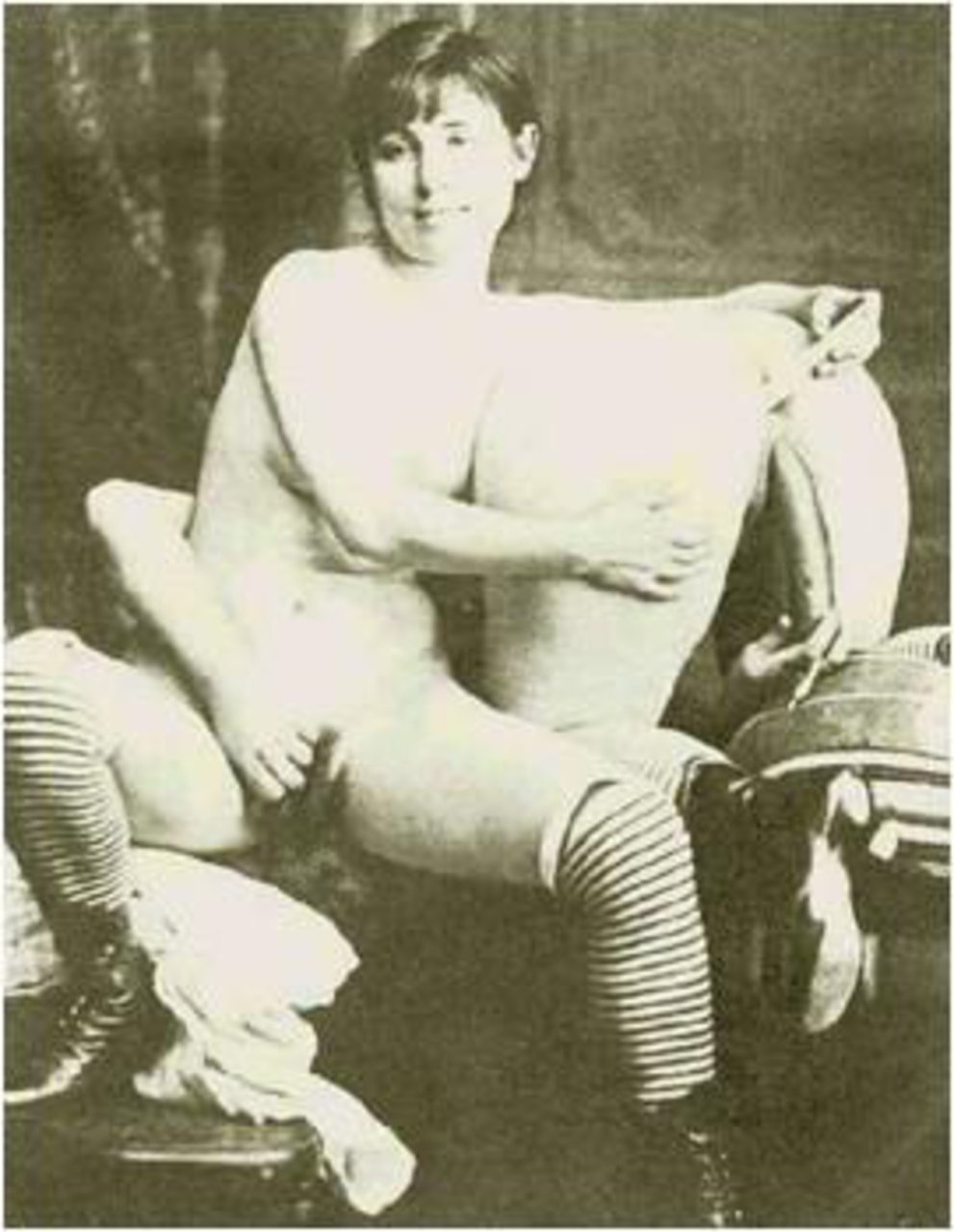 Naked Siamese twins