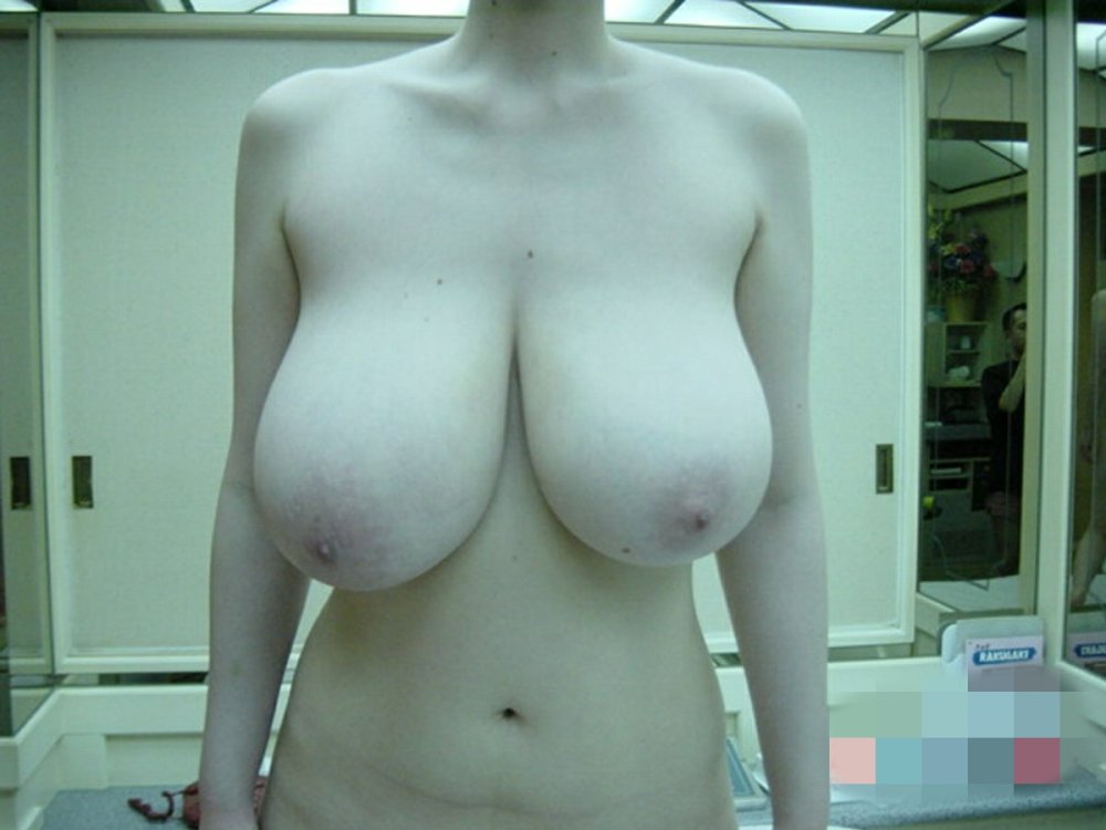 Macromastia without a bra