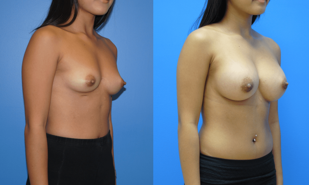 Fifth -sized naked chest