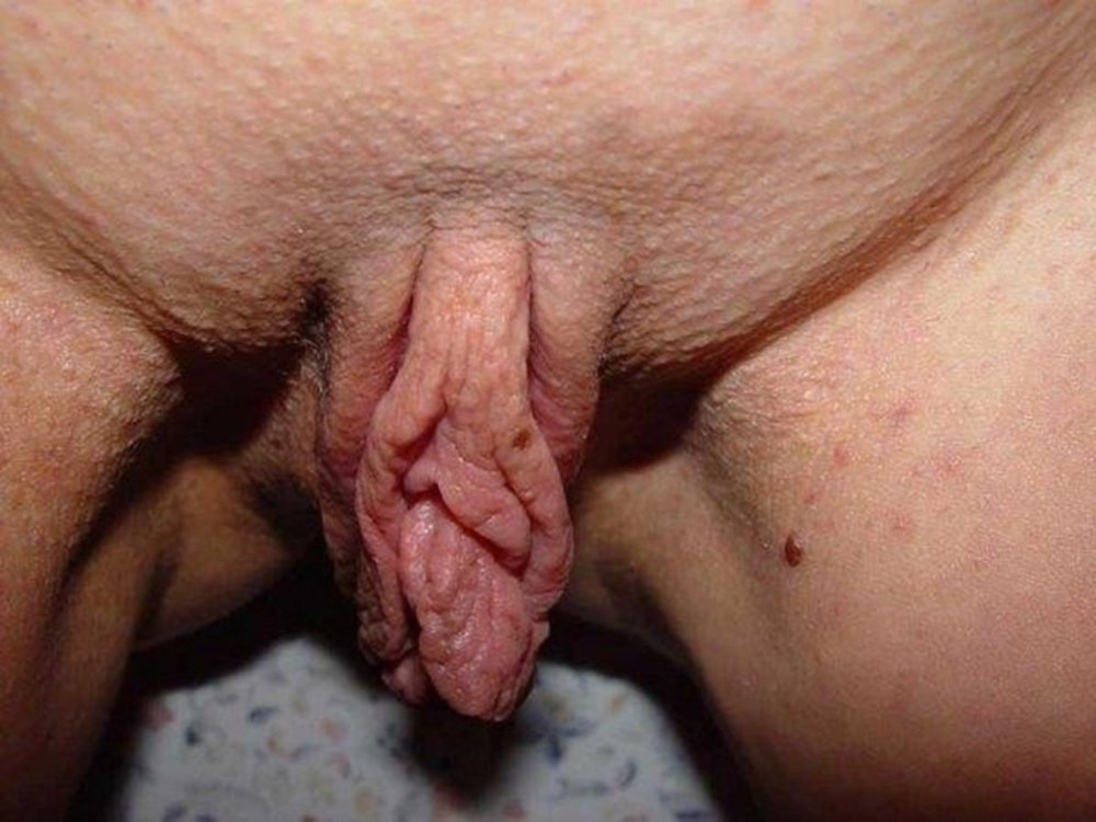 Huge clitoris and labia