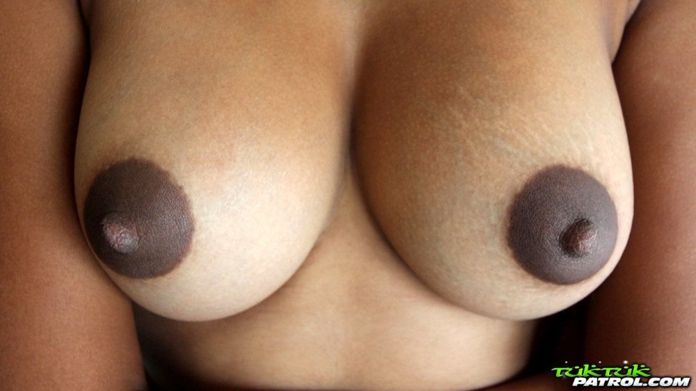 Breast with big halo