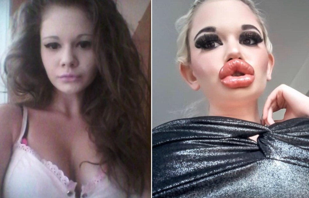 Andrea Ivanova The largest lips