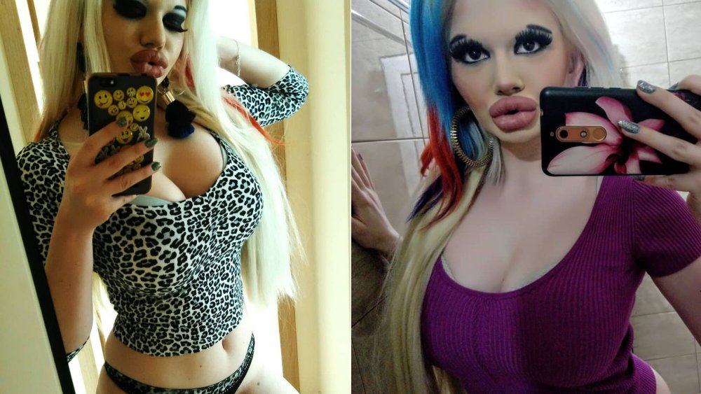 Girl with the largest lips from Bulgaria