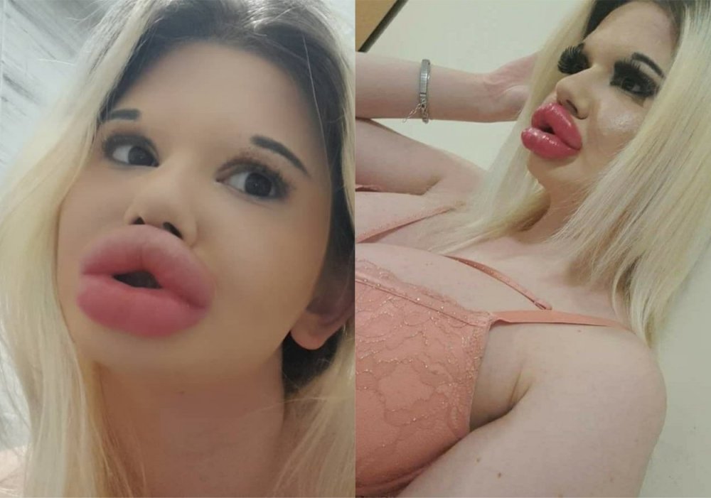 Andrea Ivanova The largest lips