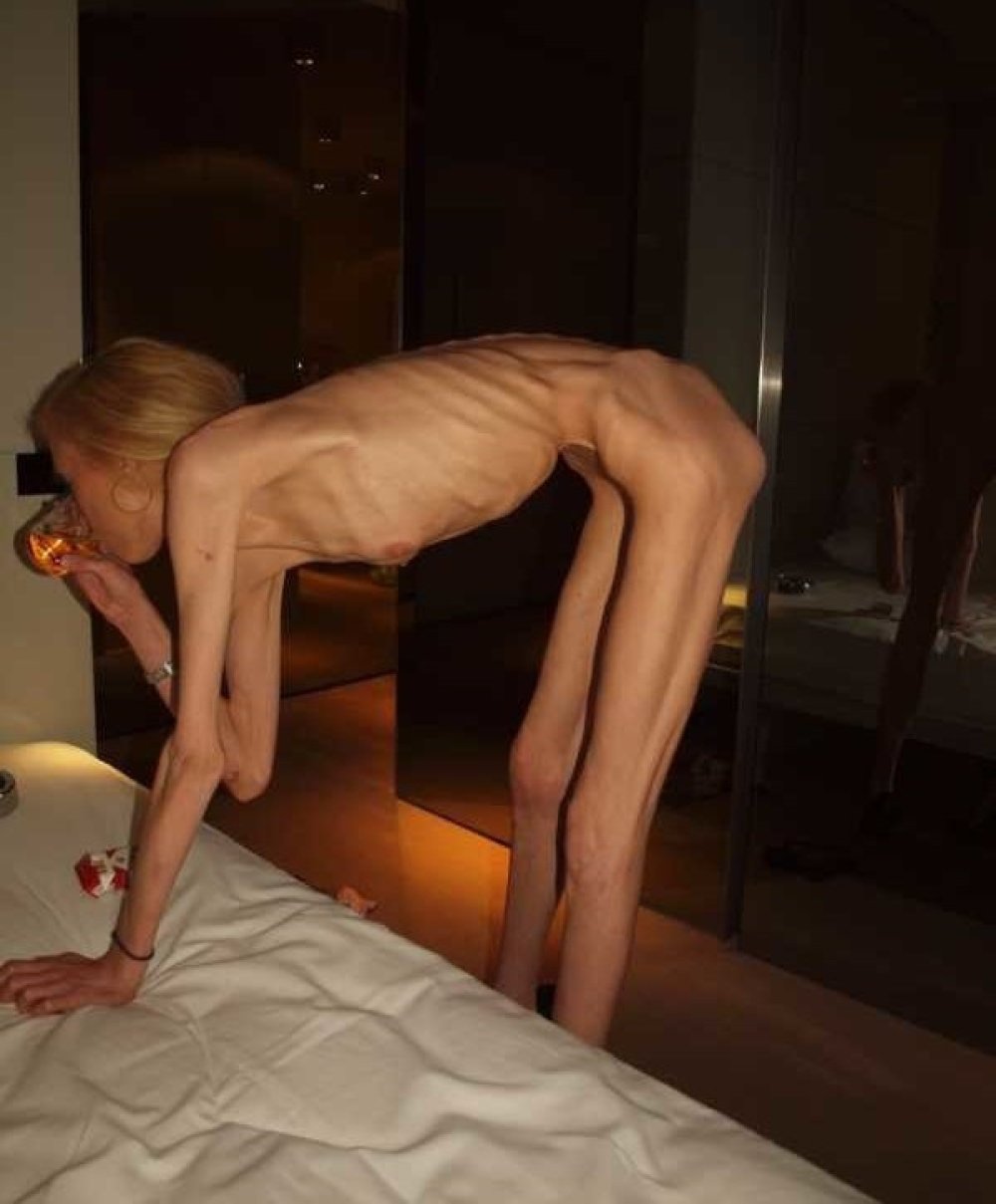Naked anorexici with big breasts