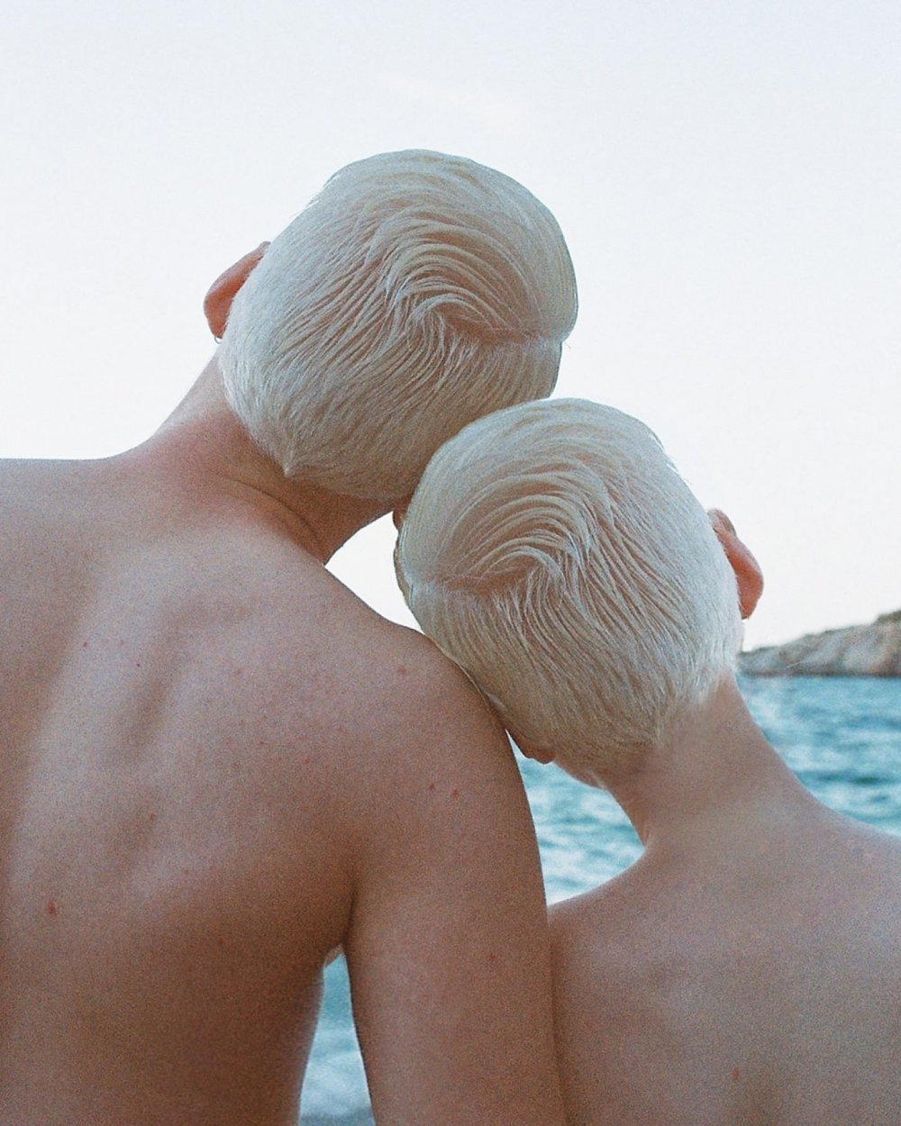 Albino man hairy naked