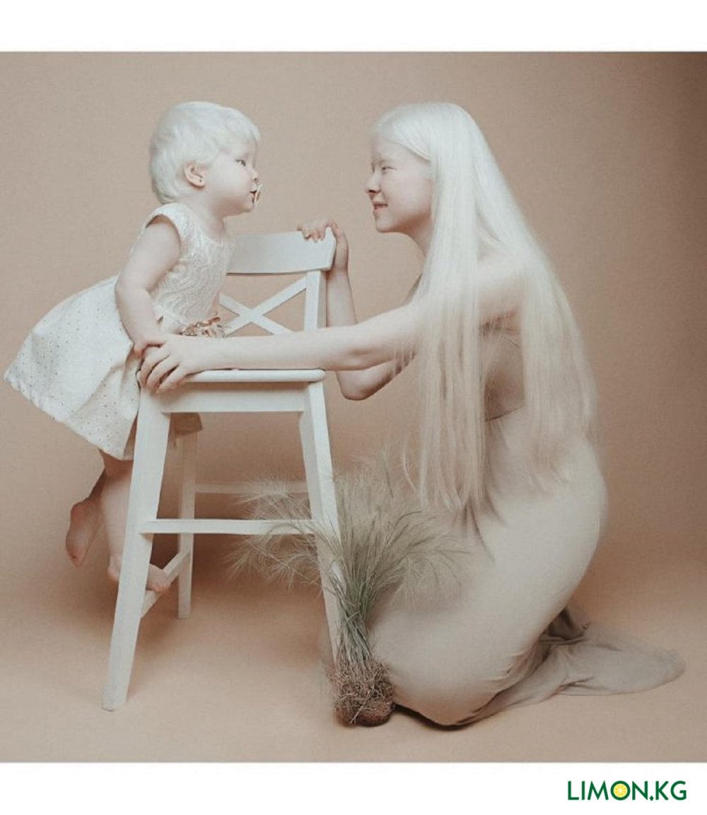 Brunet and Albino are sitting with their back photo