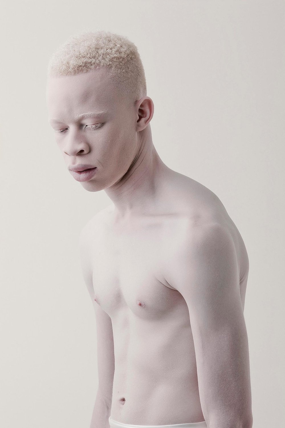 Sisters Albinos from Kazakhstan Asel