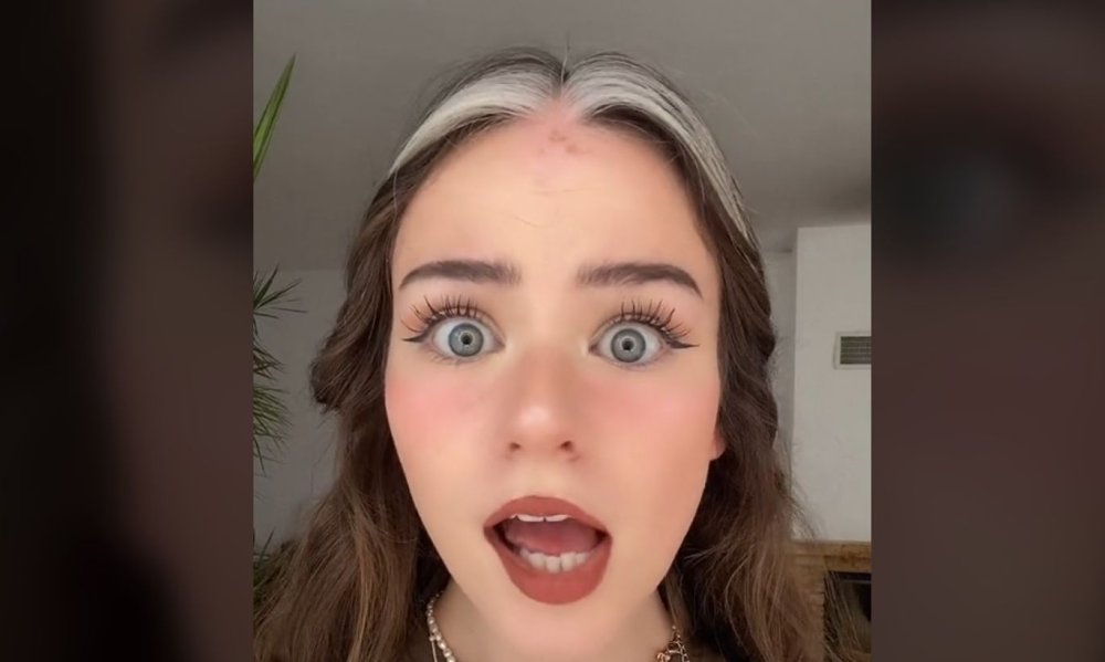 Nadine Breaty disease