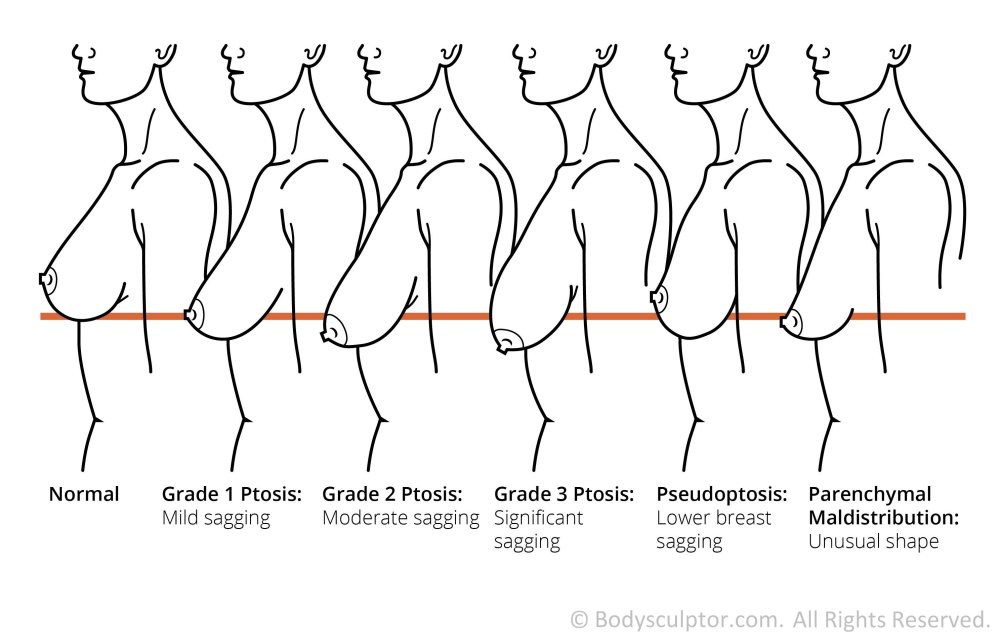 Forms of naked female breast