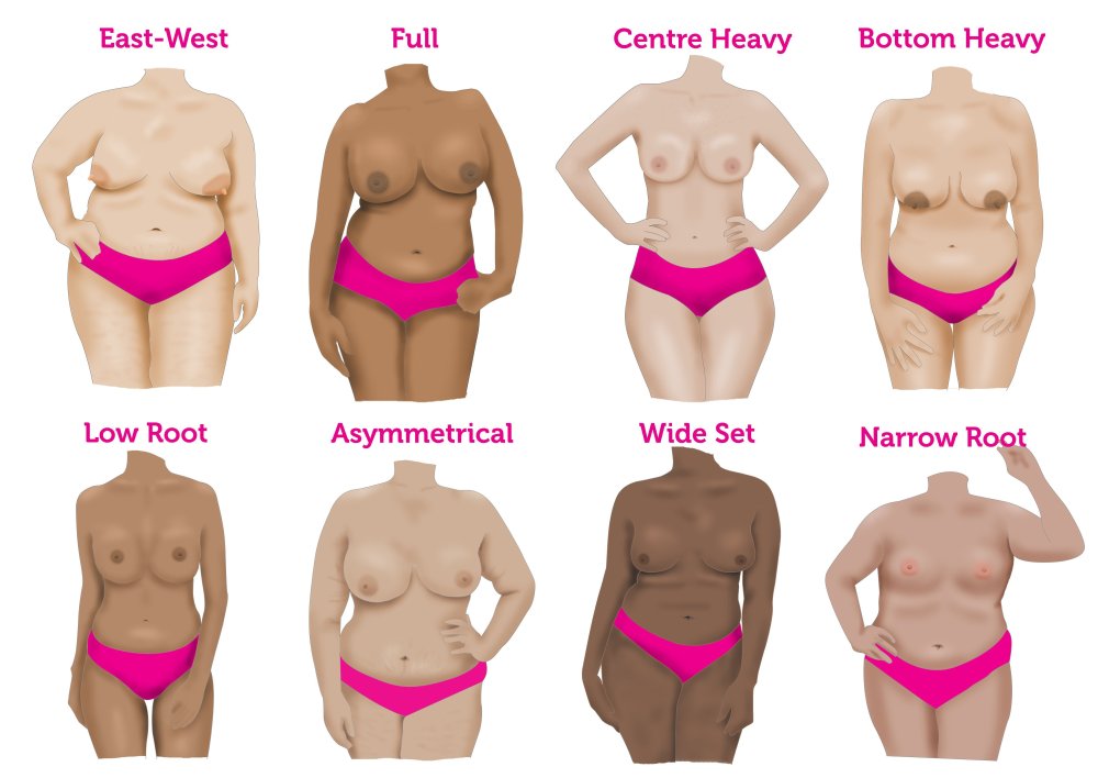 Several naked women