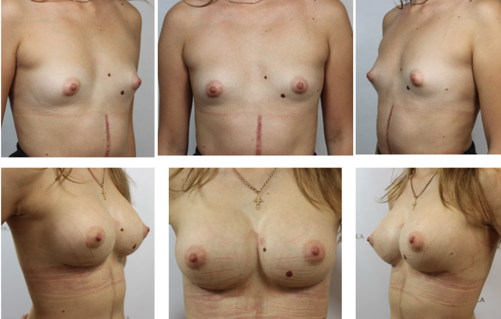 Different figures of naked women