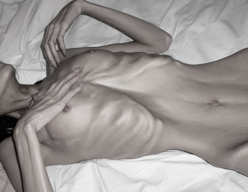 Anorexic nude girls