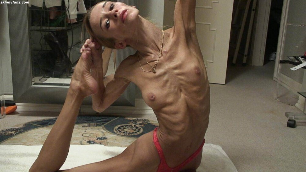 Karlitz anorexica naked