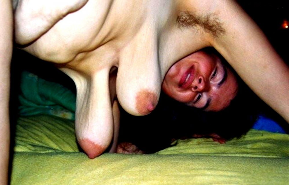 The worst boobs in the world