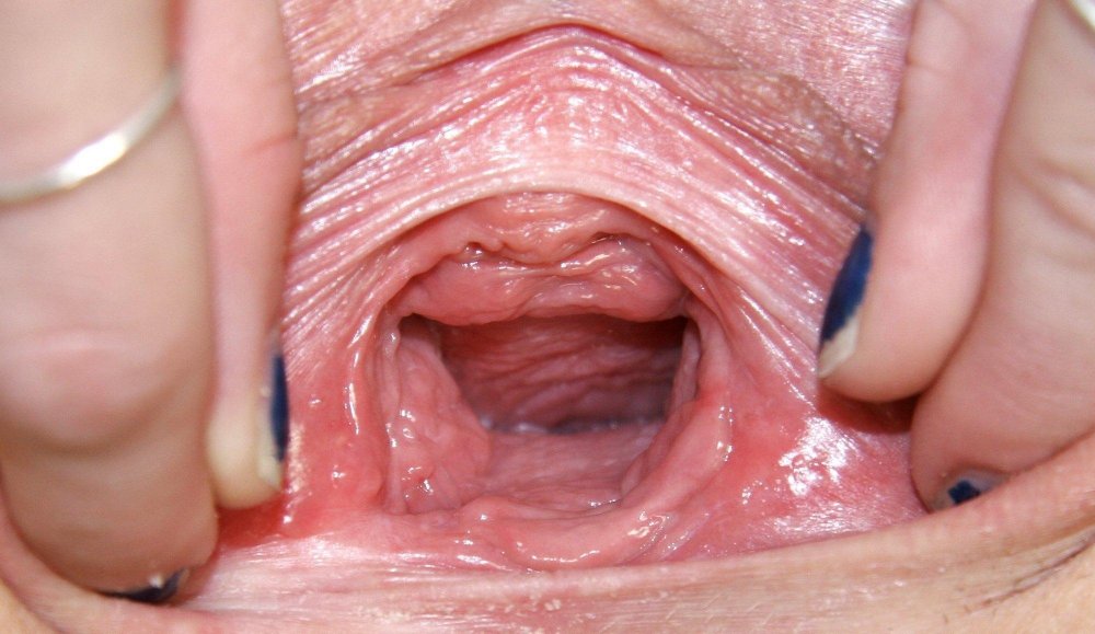 Women's vagina inside