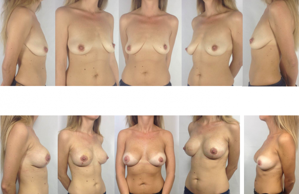 Bare tits of different sizes