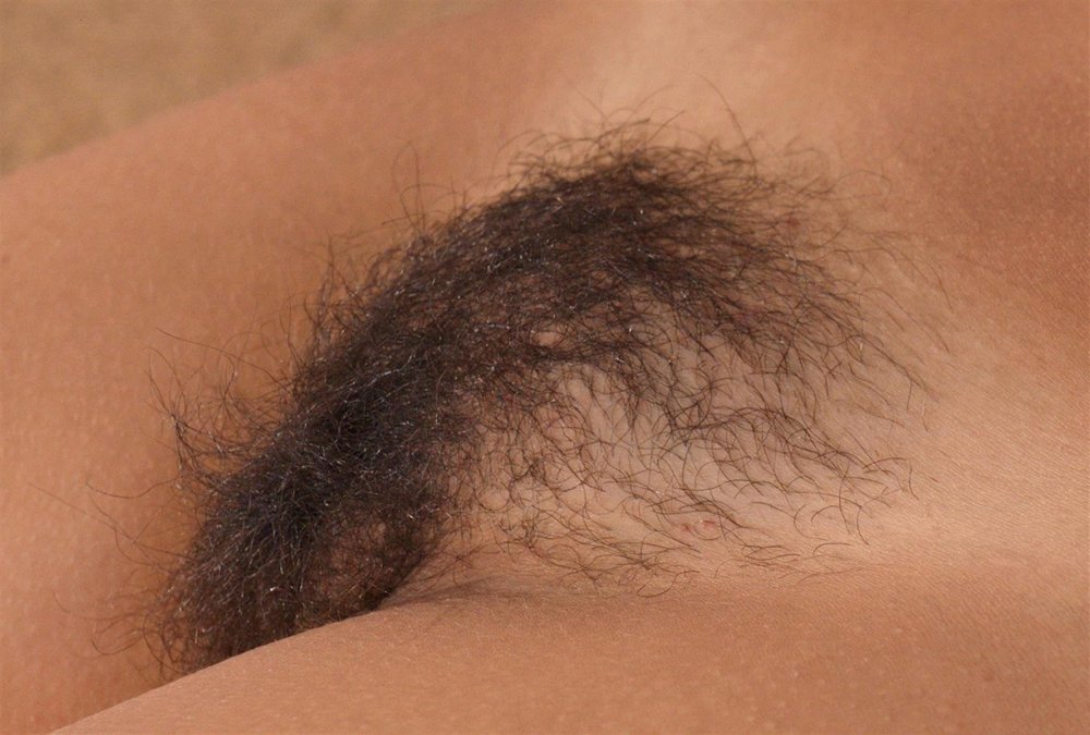 Volosters on women's pubis