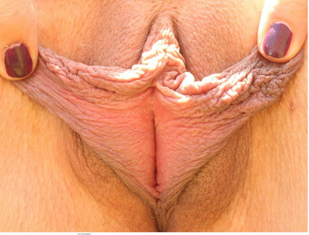 Very large sex lips