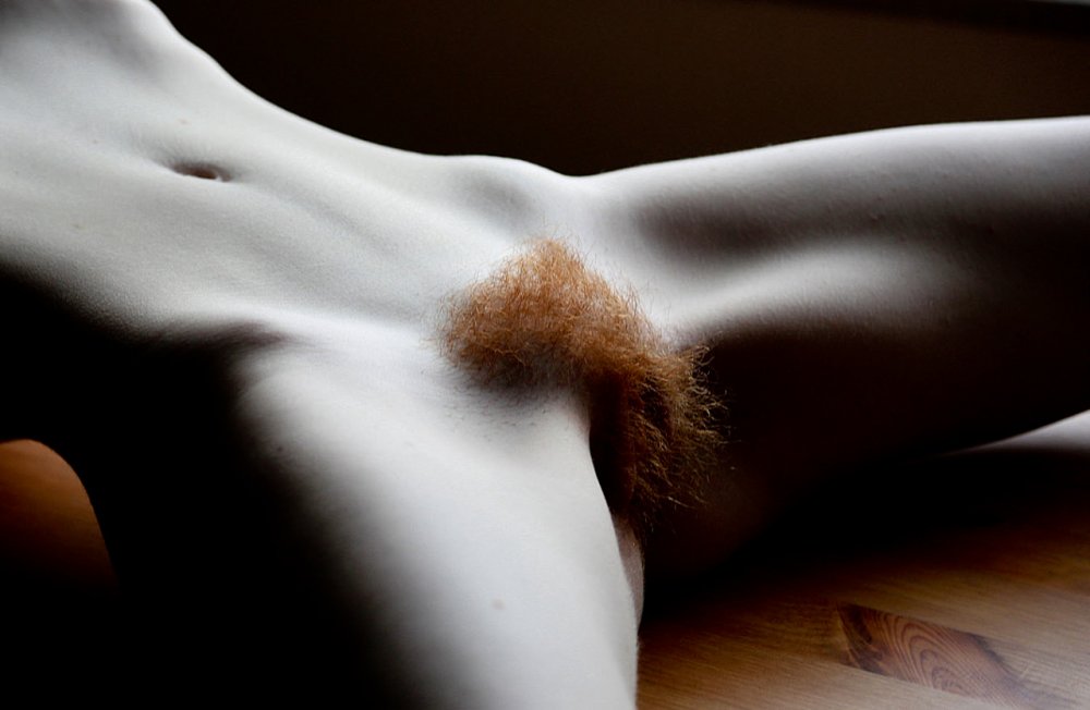 Lobo hair in women