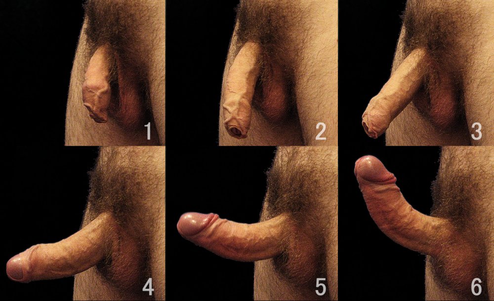 Normal male penis