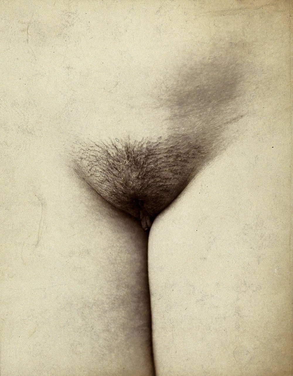 Large pubes without melting