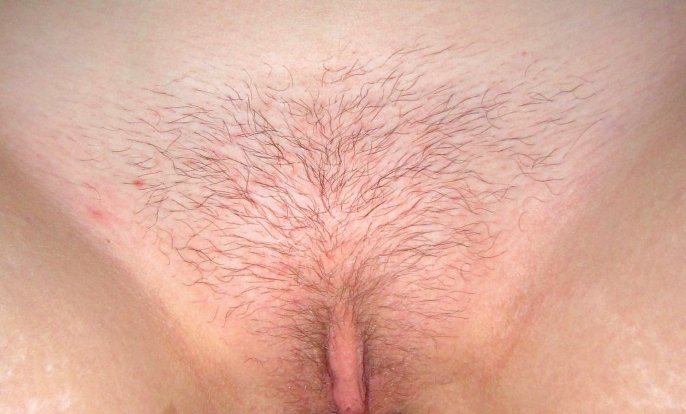 The longest pubic hair
