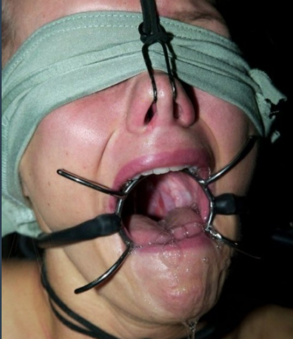 Private mouth expander