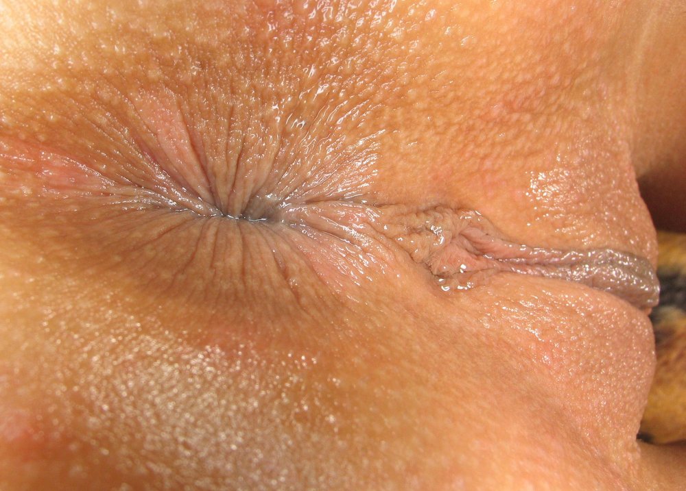 Opened female anus