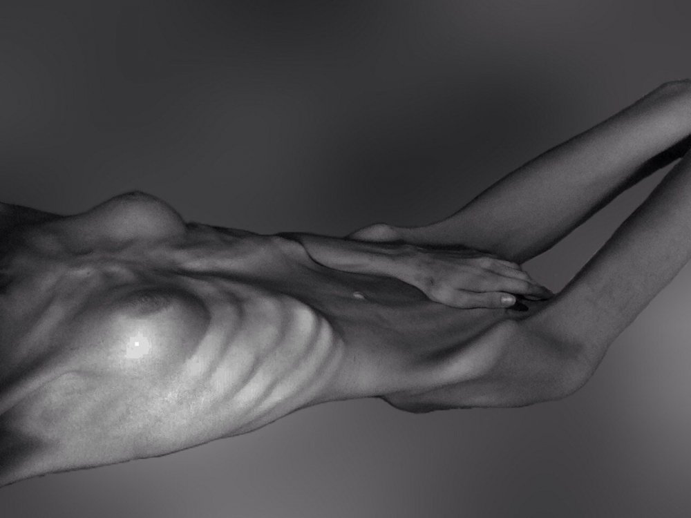 Naked women with anorexia