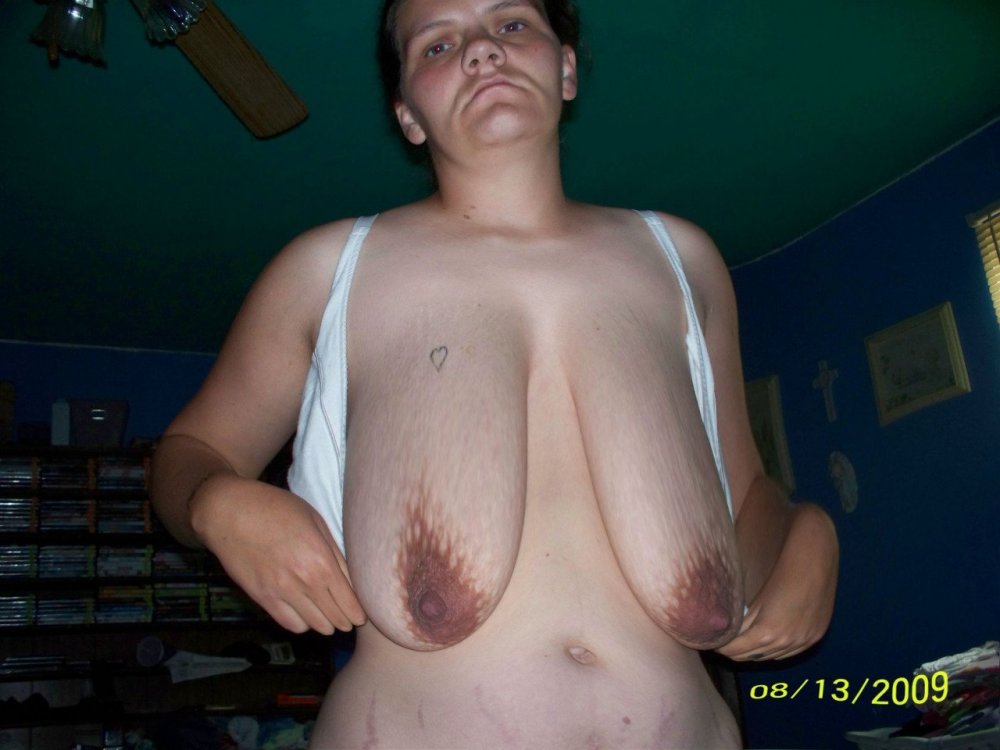 Huge ugly breasts