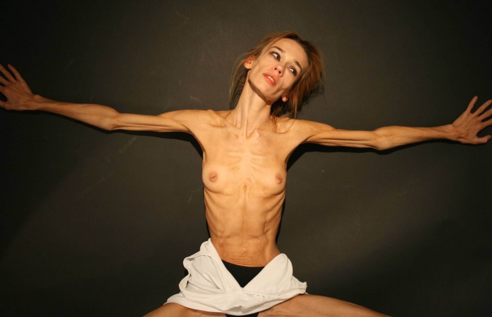 Naked thin anorexica