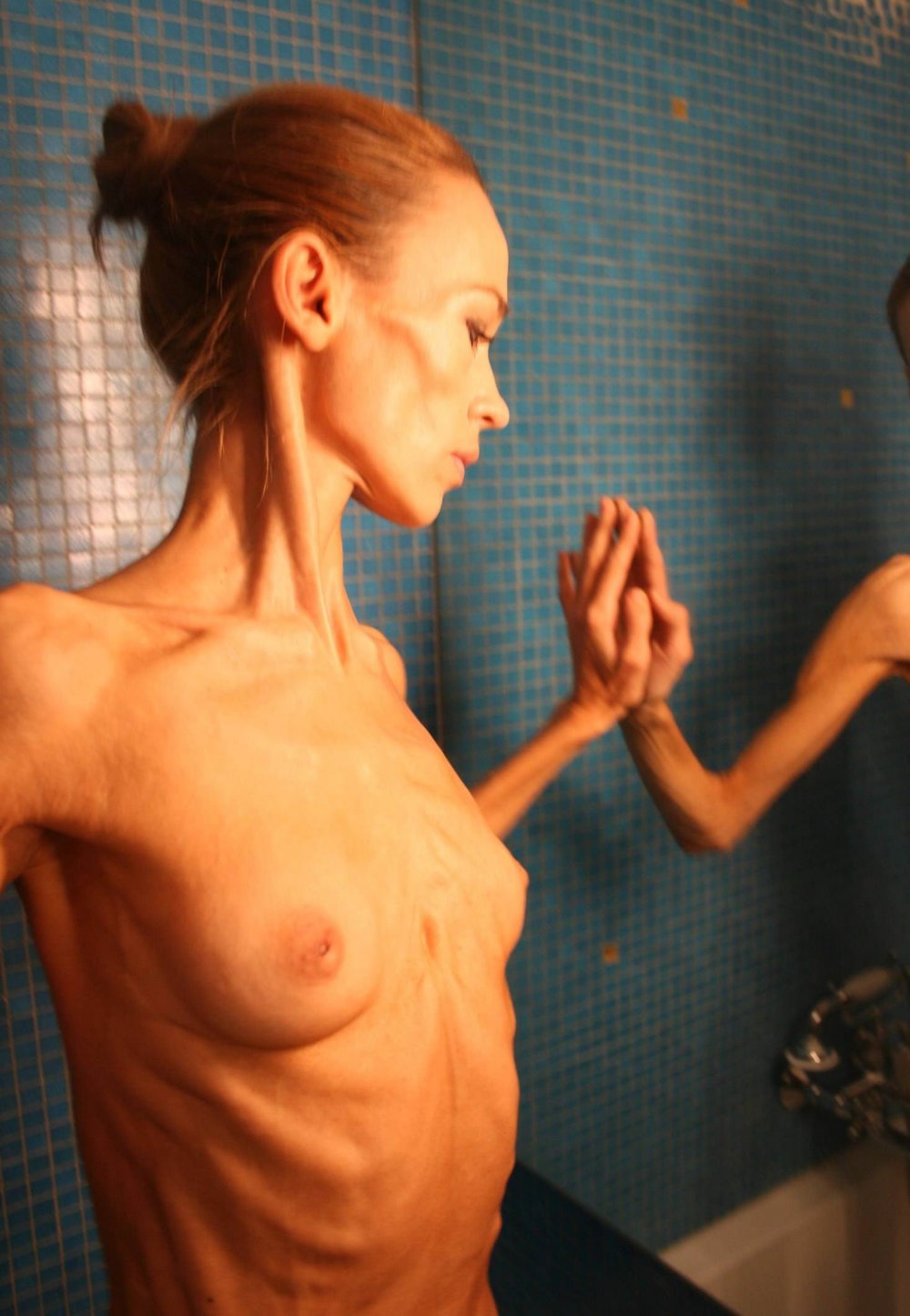 Naked anorexic girls