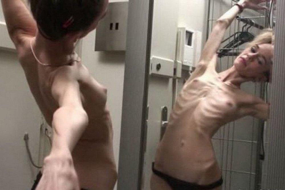 Naked anorexics photo