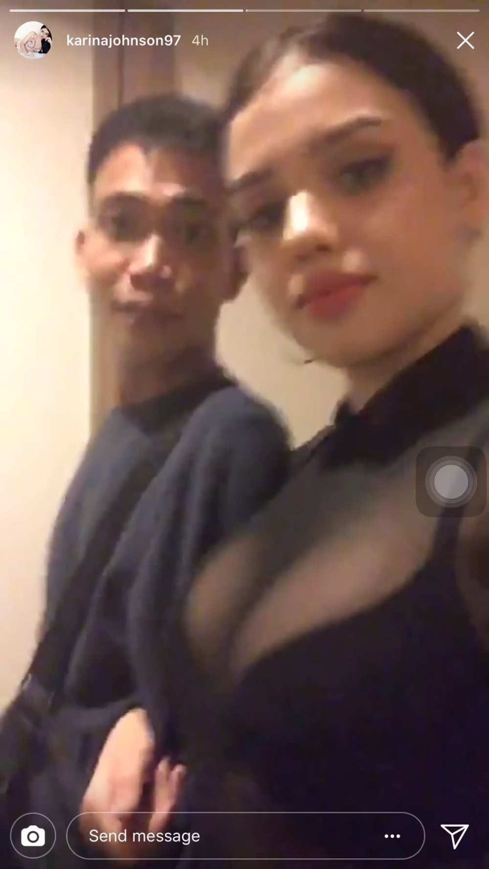 Karinajohnson97 breast