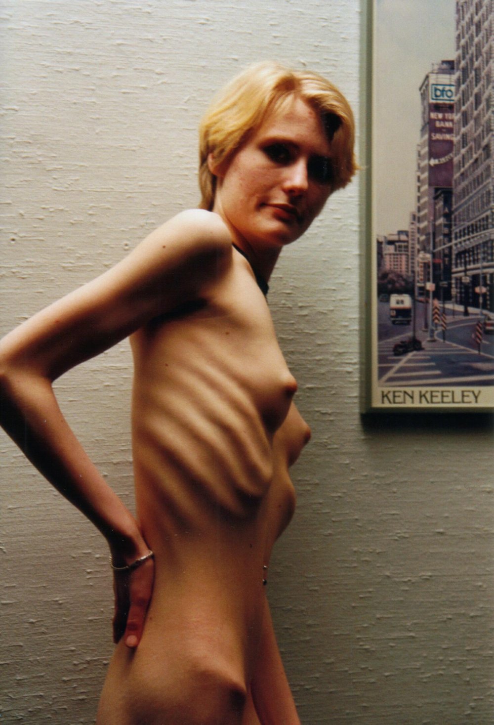 Girl anorexic standing nude