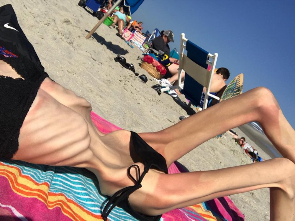 Very thin naked women